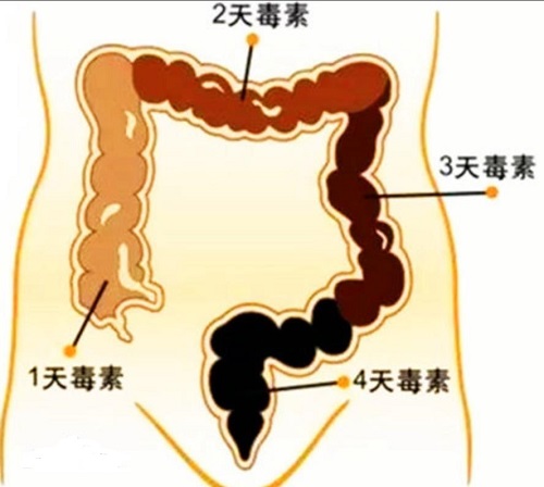 人身体到底有多少毒素?分为这两类