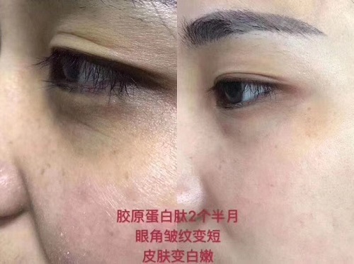 女人要怎么补充胶原蛋白？