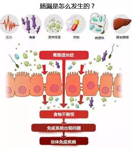 肠漏是什么原因造成的 吃什么有助于修复