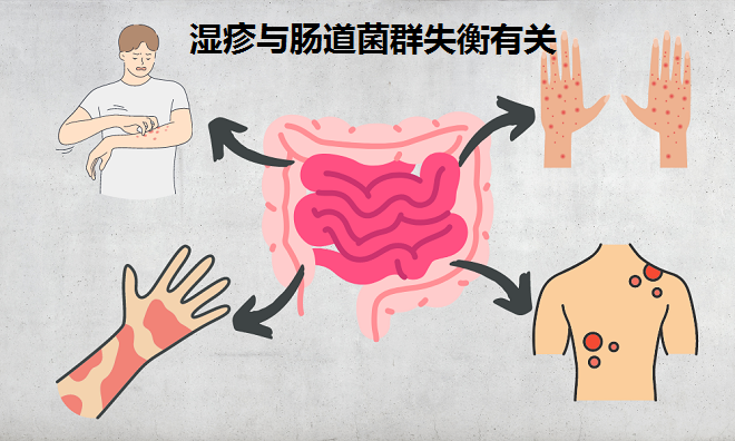 湿疹来报到 问题在肠道 摆脱湿疹试试这招