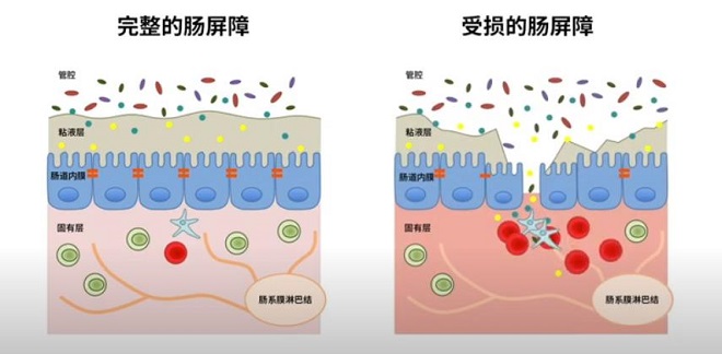 肠漏症是什么，怎么判断自己是否有肠漏症？