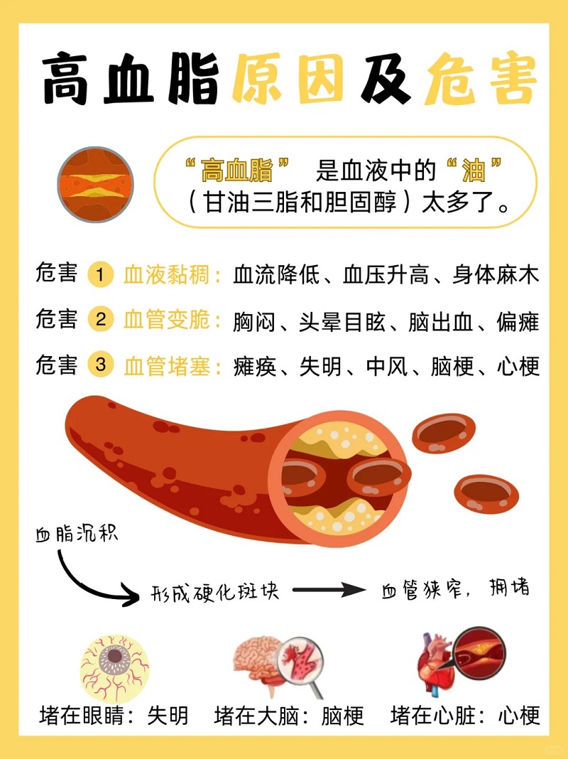  吃了几千块鱼油，为什么血脂还没降下来？弄明白少花冤枉钱